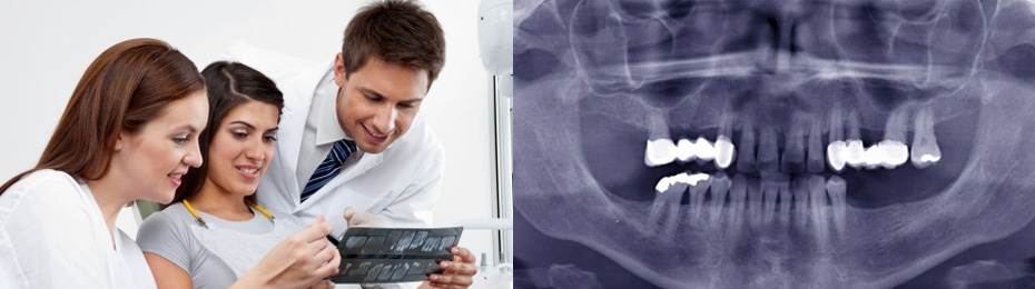 Orthopentogram(OPG)